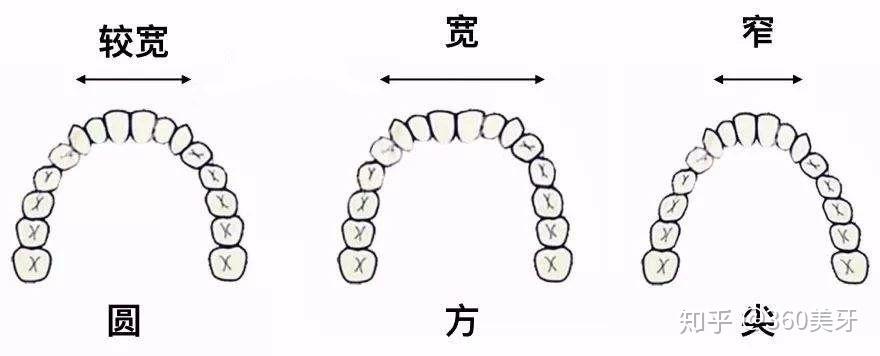 某宝上几十块的牙套你真的敢用吗