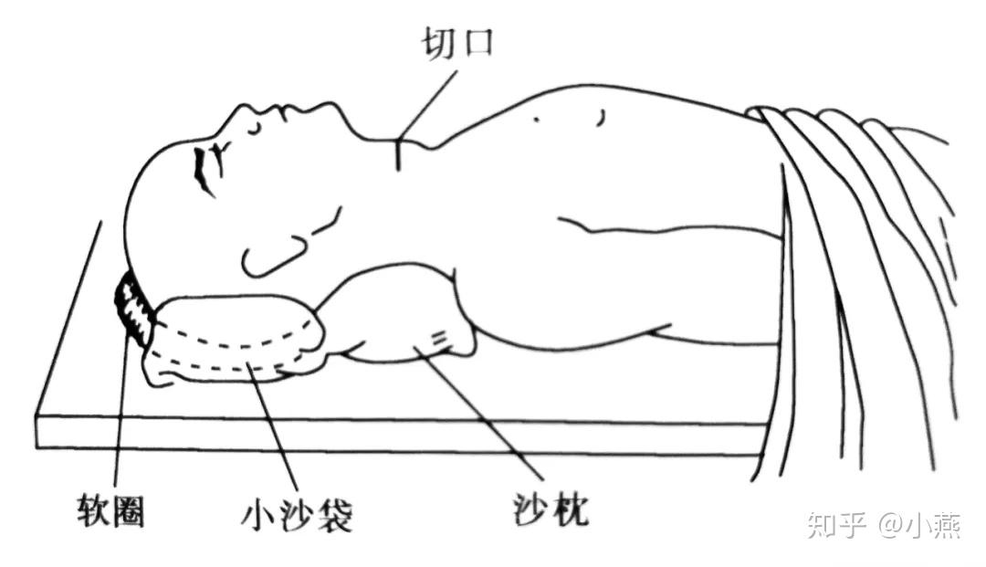 气管推移训练图解图片