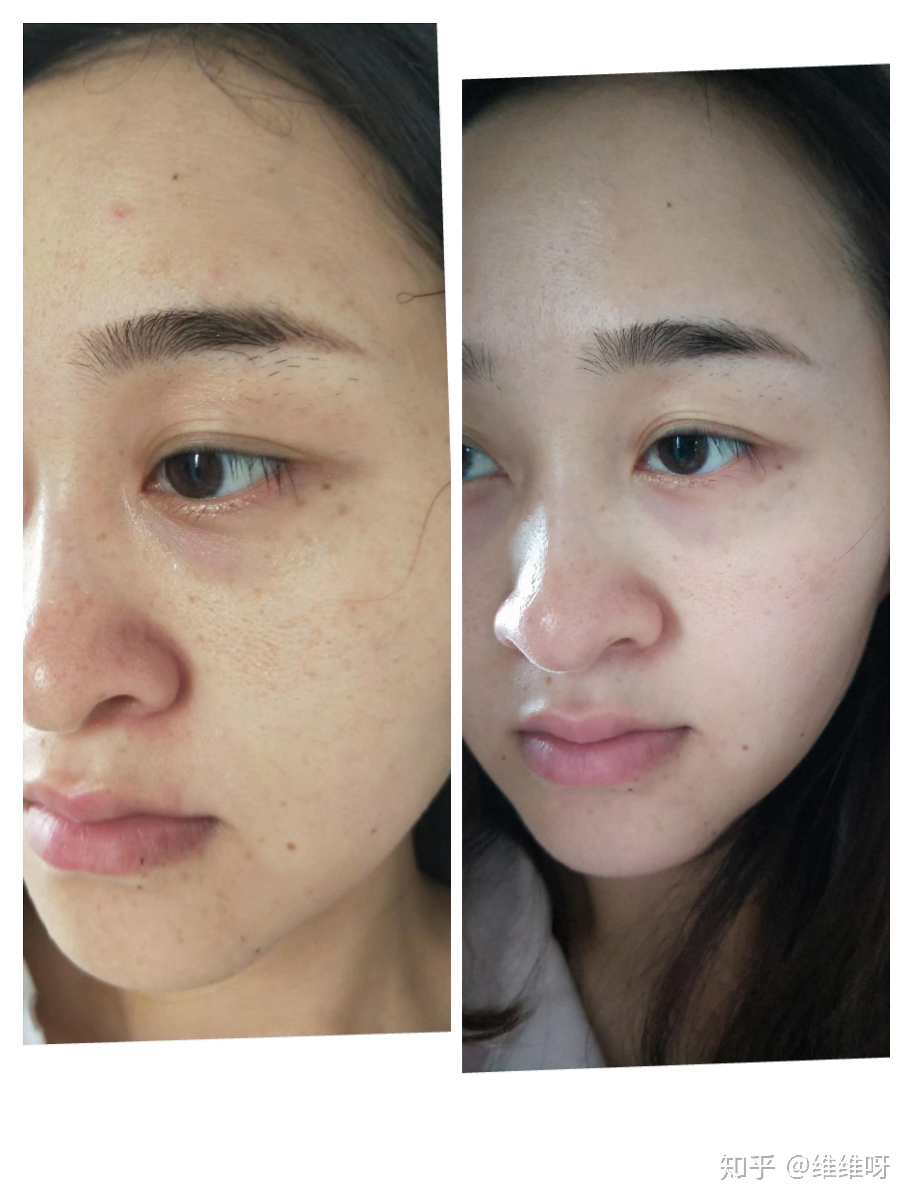 抗糖美白丸真的有用吗