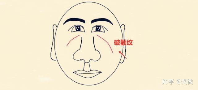 细数你脸上的纹路下篇 - 知乎