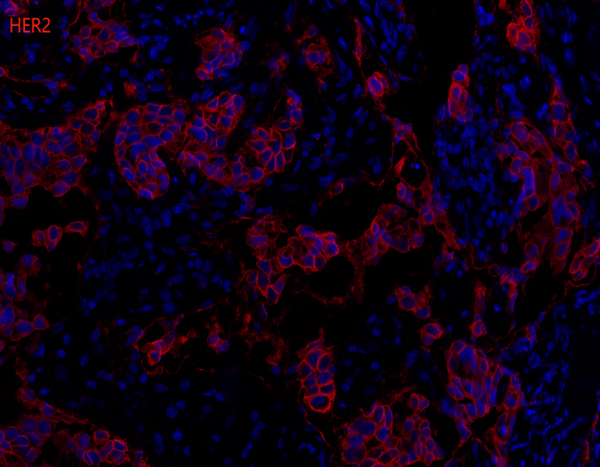mIHC多色免疫荧光染色一抗怎么选？ - 知乎