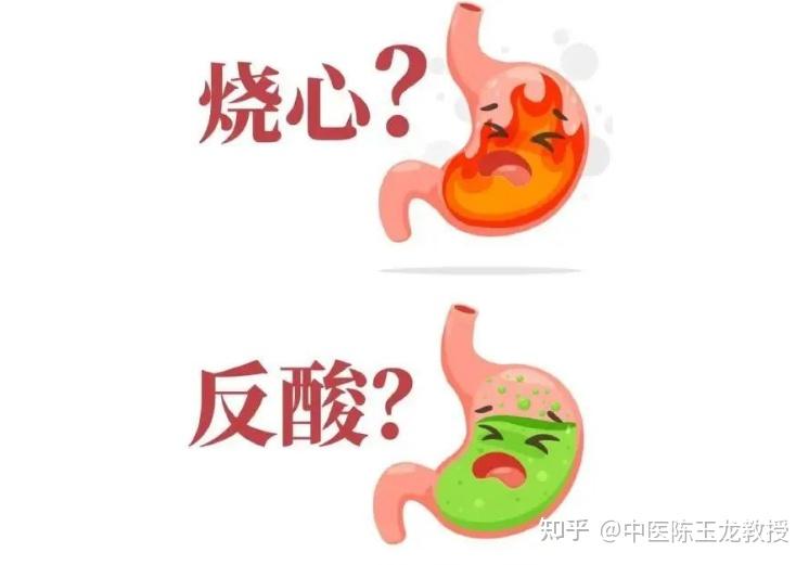 一个民间验方，轻松解决反流性胃炎食管炎，反酸 烧心 溃疡统统搞定 - 知乎