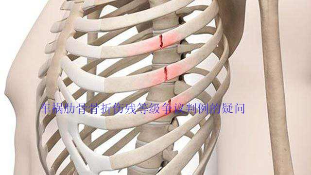 车祸肋骨被撞骨折保险公司怎么赔偿?