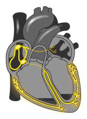 室上性心动过速的鉴别思路 - 知乎