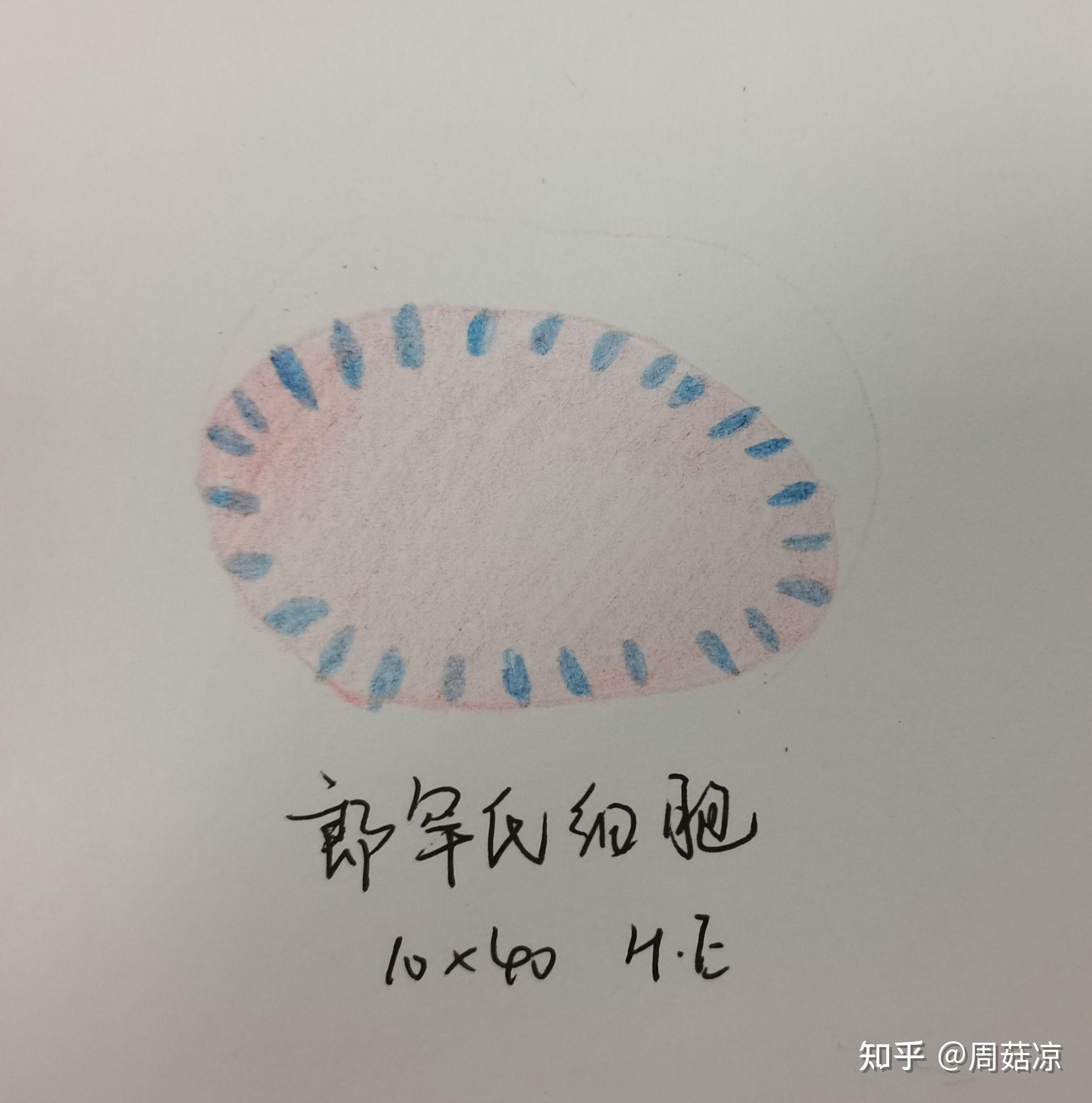 病理学实验报告 标本手绘图-炎症细胞的识别 - 知乎