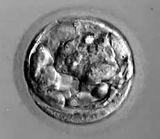 美国试管婴儿：这样的囊胚才是极好的！ - 知乎