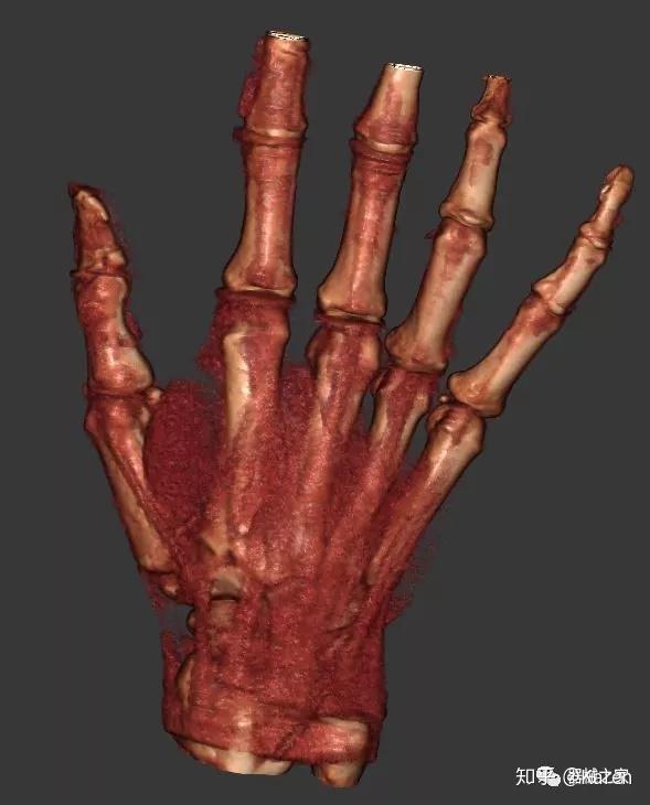 大开眼界全世界最小的ct扫描仪重量仅300磅