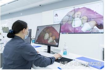 口扫凭啥能代替传统取模? - 知乎