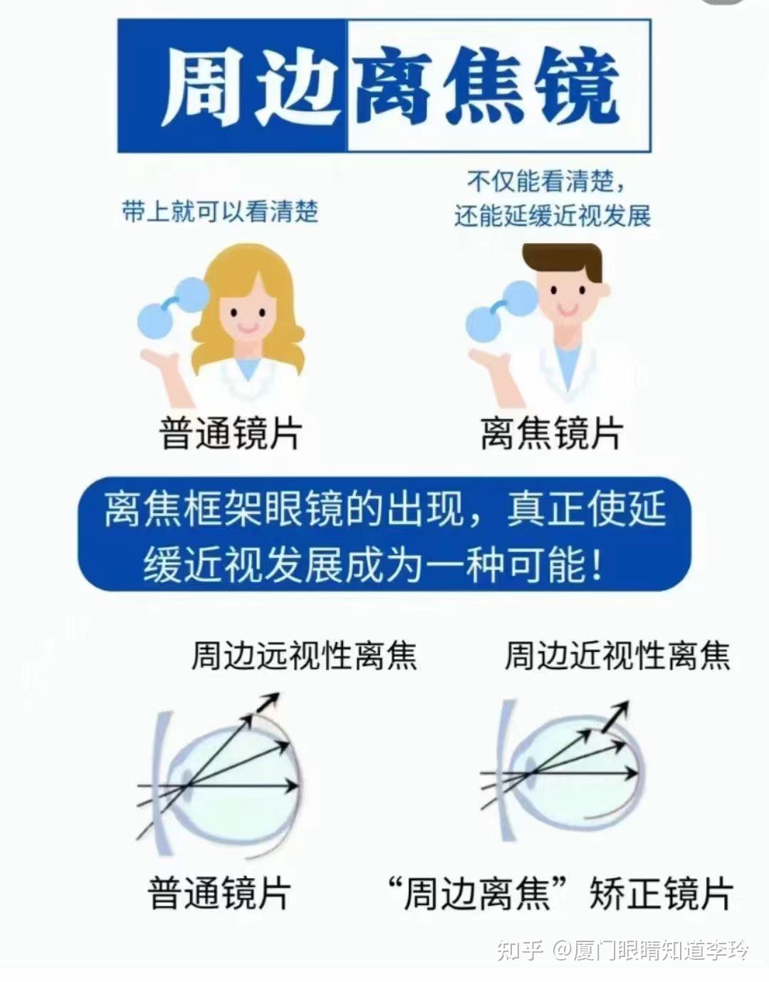 什么是离焦眼镜 一张图带你了解! - 知乎