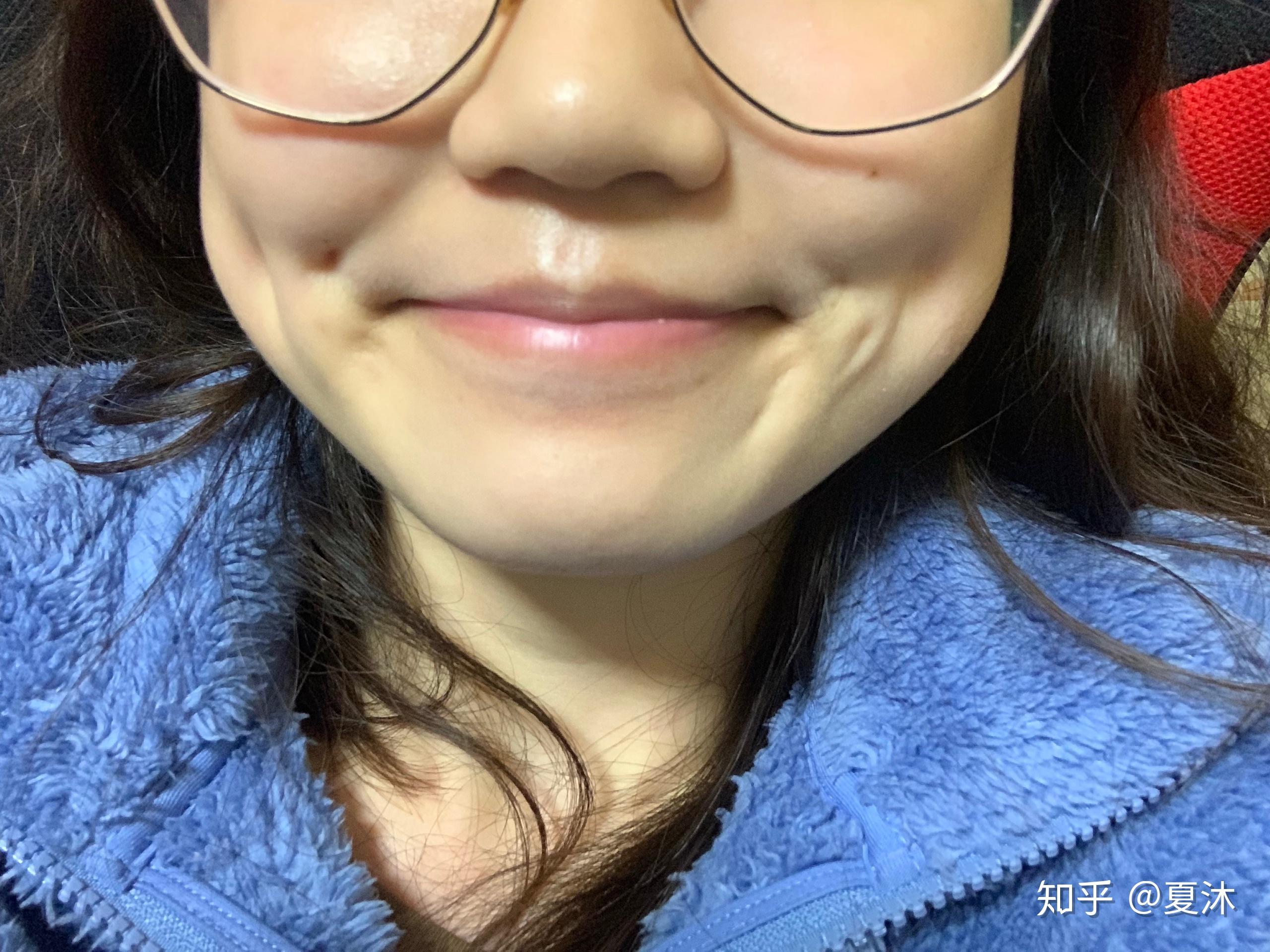 有四个酒窝是怎样一种体验