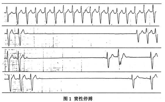v2-03250de0a3e68e915599bcae3c234a4c_1440w.jpg?source=172ae18b
