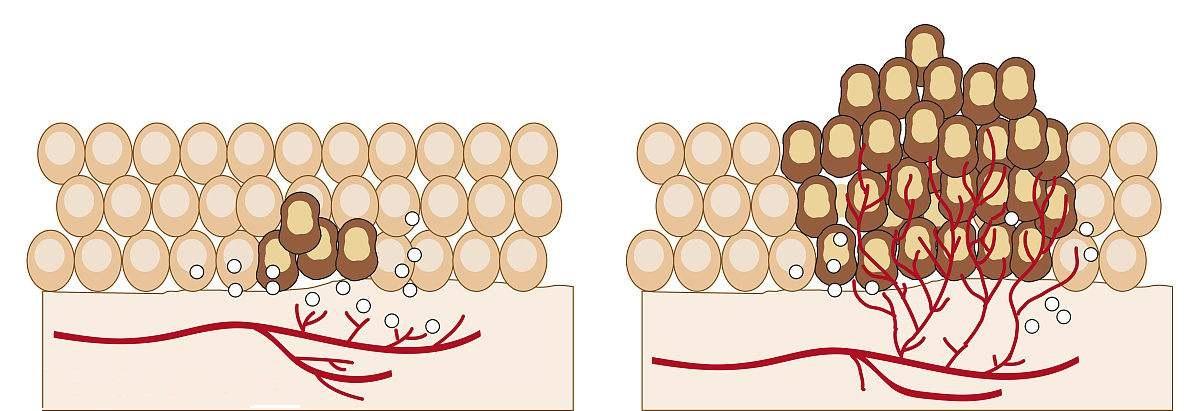 血小板源生长因子（PDGF）与肿瘤 知乎
