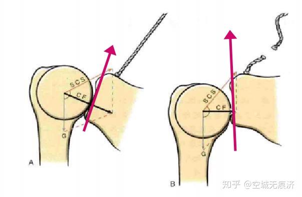 上回旋和下回旋图解图片