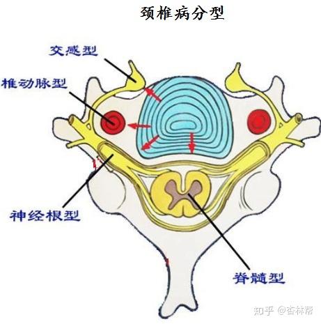 v2-0378cebe5983f7acd8cec9cdde24a57e_r.jpg