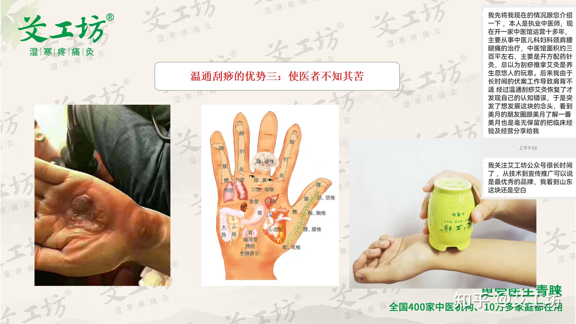 你想拥有一项中医特色技能吗?温通刮痧是小白也能学会的中医适宜新技术! - 知乎