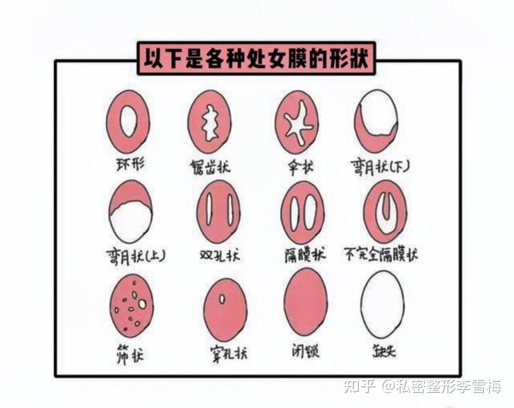 女人的私处有几种图片