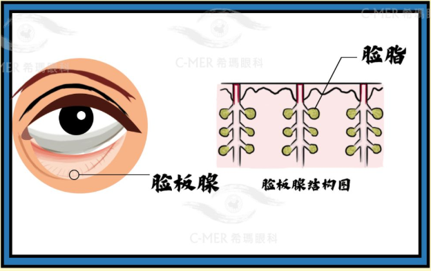 眼屎粘稠?可能是眼睛在“求救”!有这4个症状,小心眼睛亮红灯 - 知乎