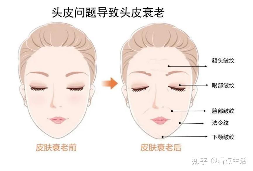 头皮抗衰比面部更迫切，丝域养发馆抗衰秘籍 - 知乎