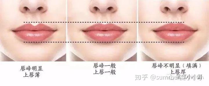 详解：人中沟是如何增加或者拖累颜值的|日本医美 - 知乎