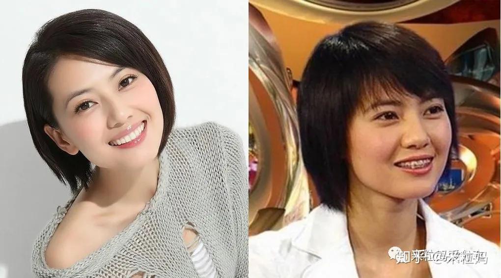 整牙,除了让牙齿排列整齐以外,还包括调整颚骨,把过宽的颚骨往窄了