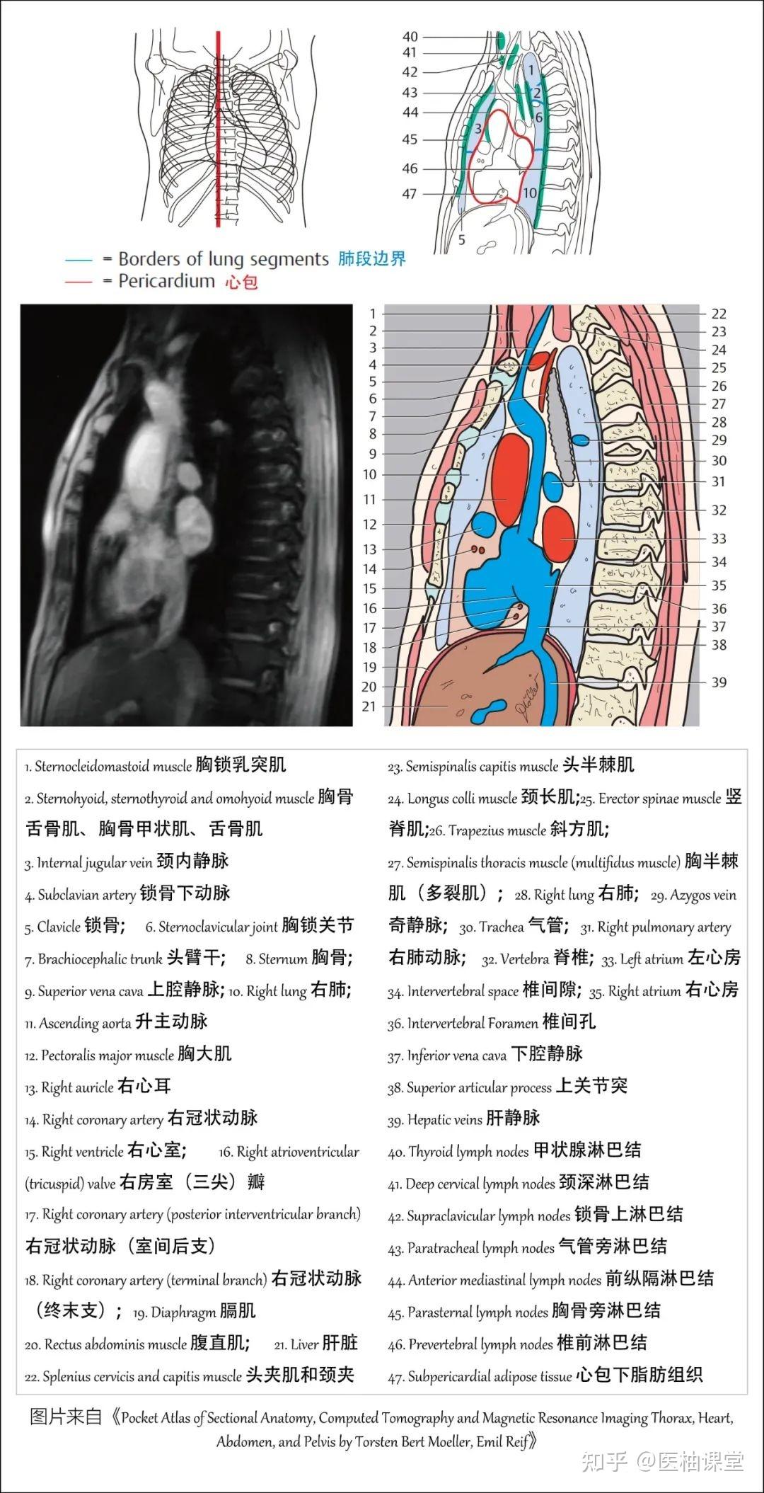 右肺叶间裂示意图图片