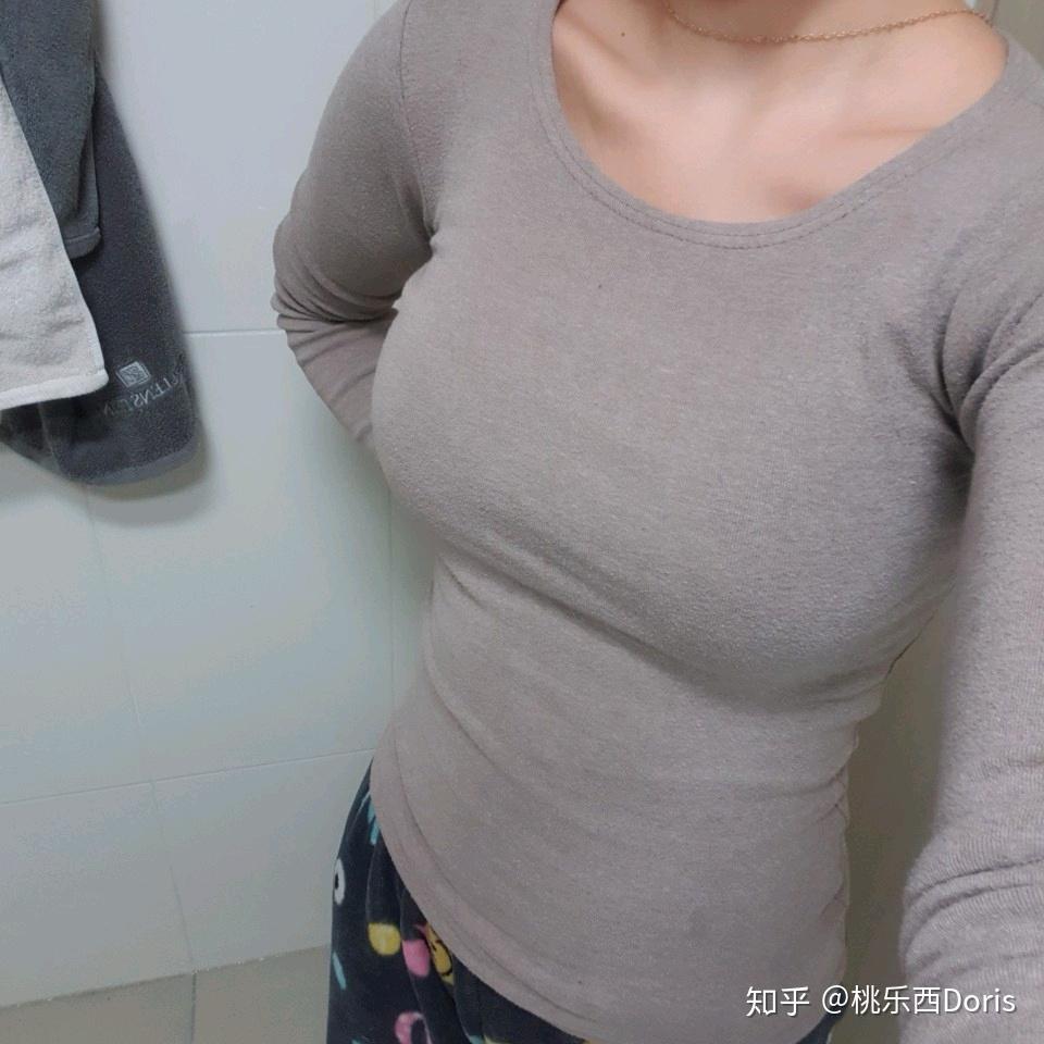删这是术前,胸部比较垂和干瘪图源网络侵删图源网络侵删这是假体术后