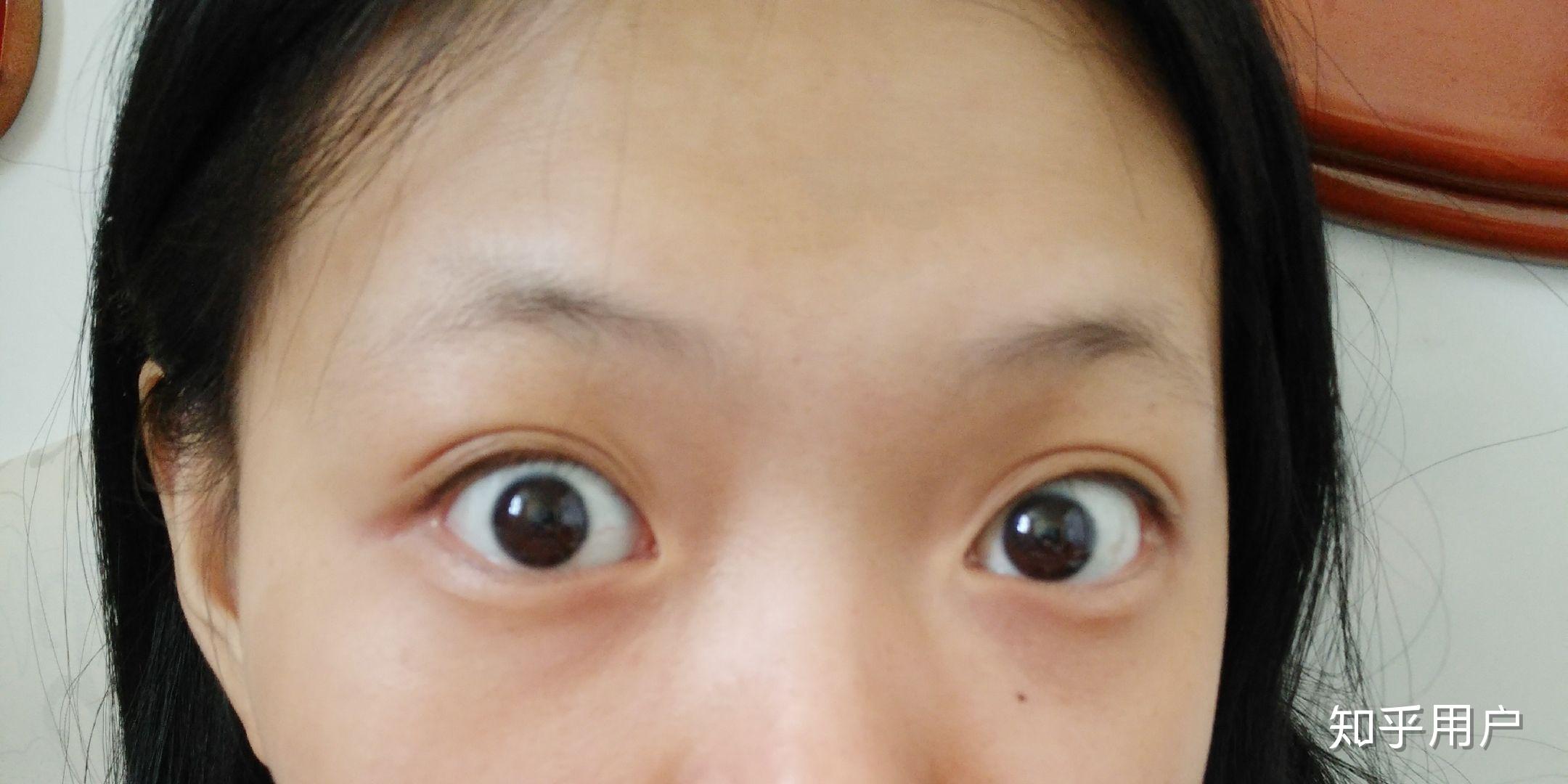 正常人的眼睛能睁这么大吗,还是说开了眼角? - 知乎