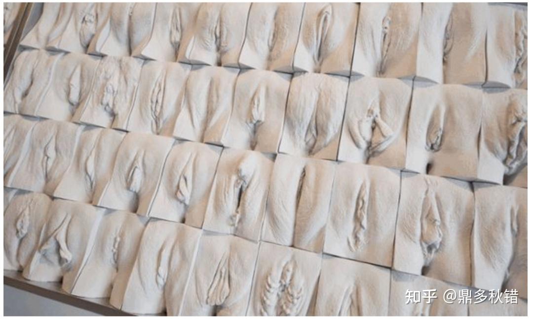 我的外阴为什么跟网上看到的不一样