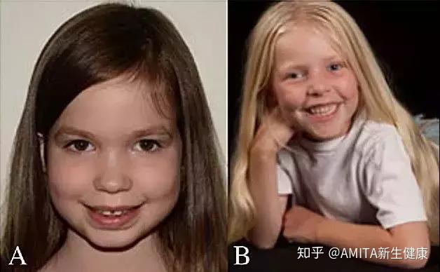 “XXY” or “XYY”:带你走进真实的“第三性别”群体 - 知乎