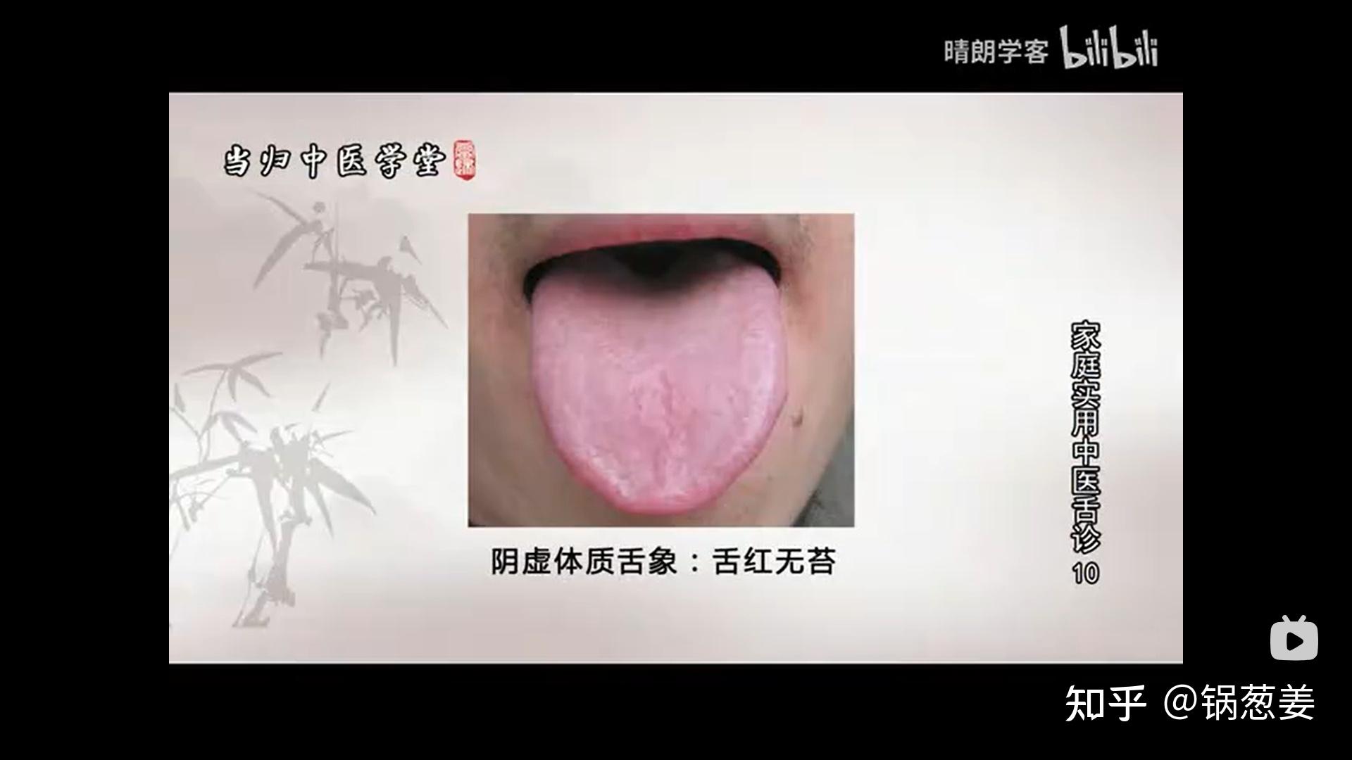 舌诊-阴虚 - 知乎