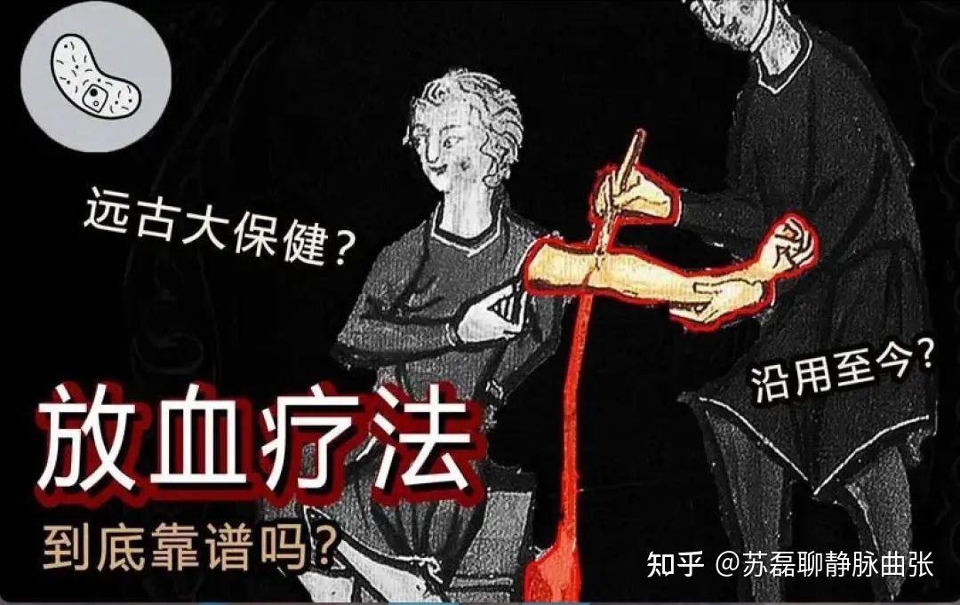 苏磊医生:那些静脉曲张放血治疗的患者故事,带给我们的启示 - 知乎