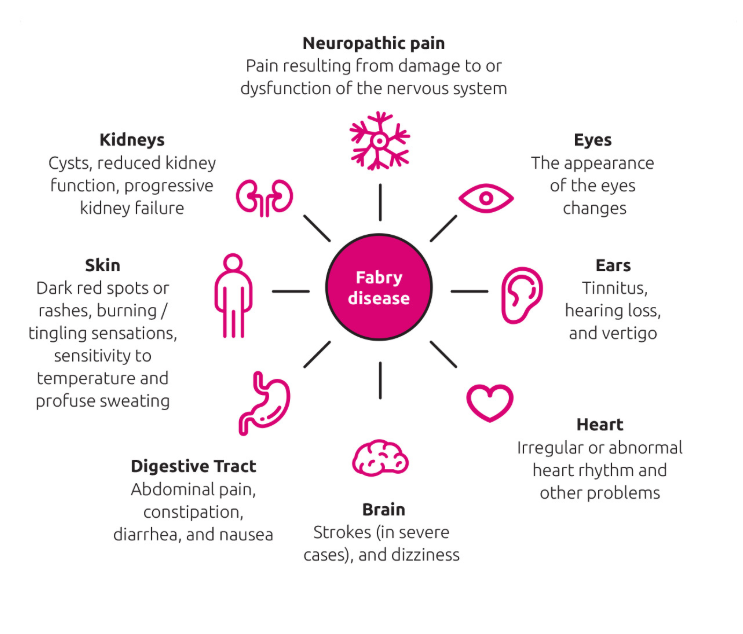 单基因遗传病之法布里病fabrysdisease