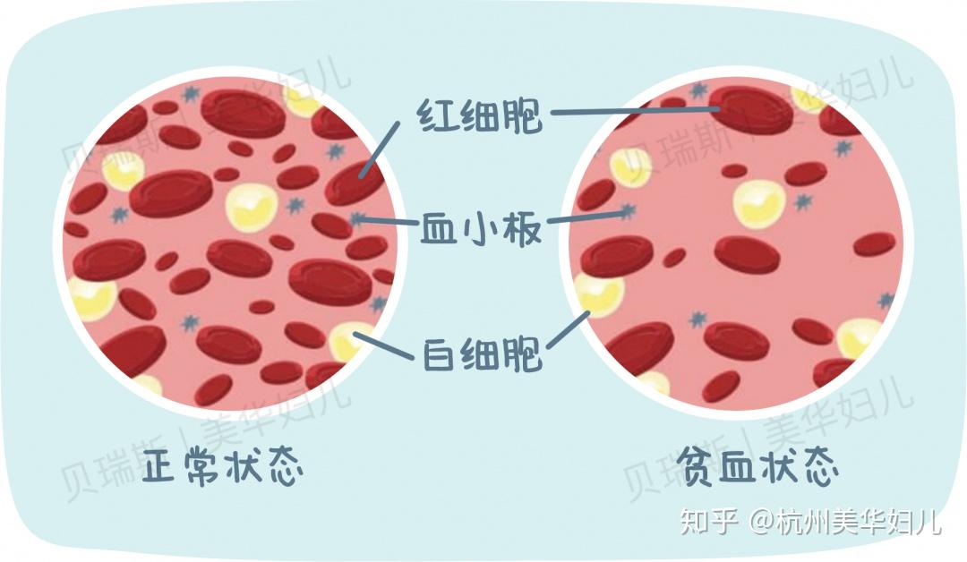 低蛋白血症血红蛋白会低吗_血红蛋白偏低的原因及危害是什么_蛋白低是白蛋白还是血红蛋白