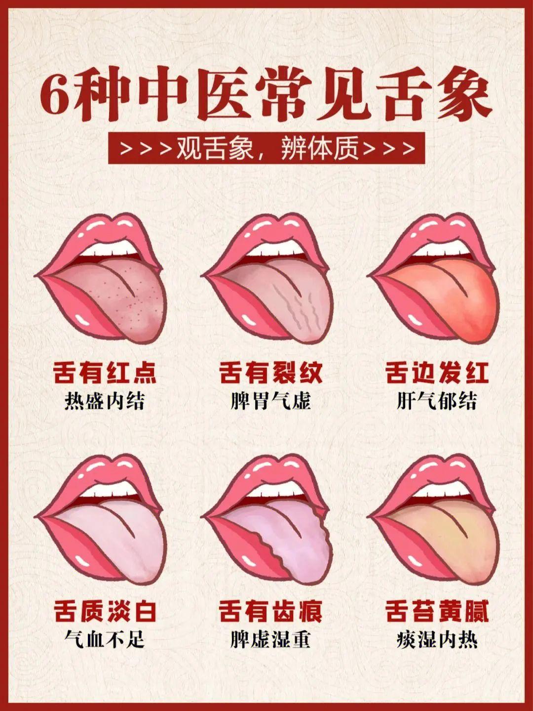 四种舌苔颜色,揭露你的身体状况! - 知乎