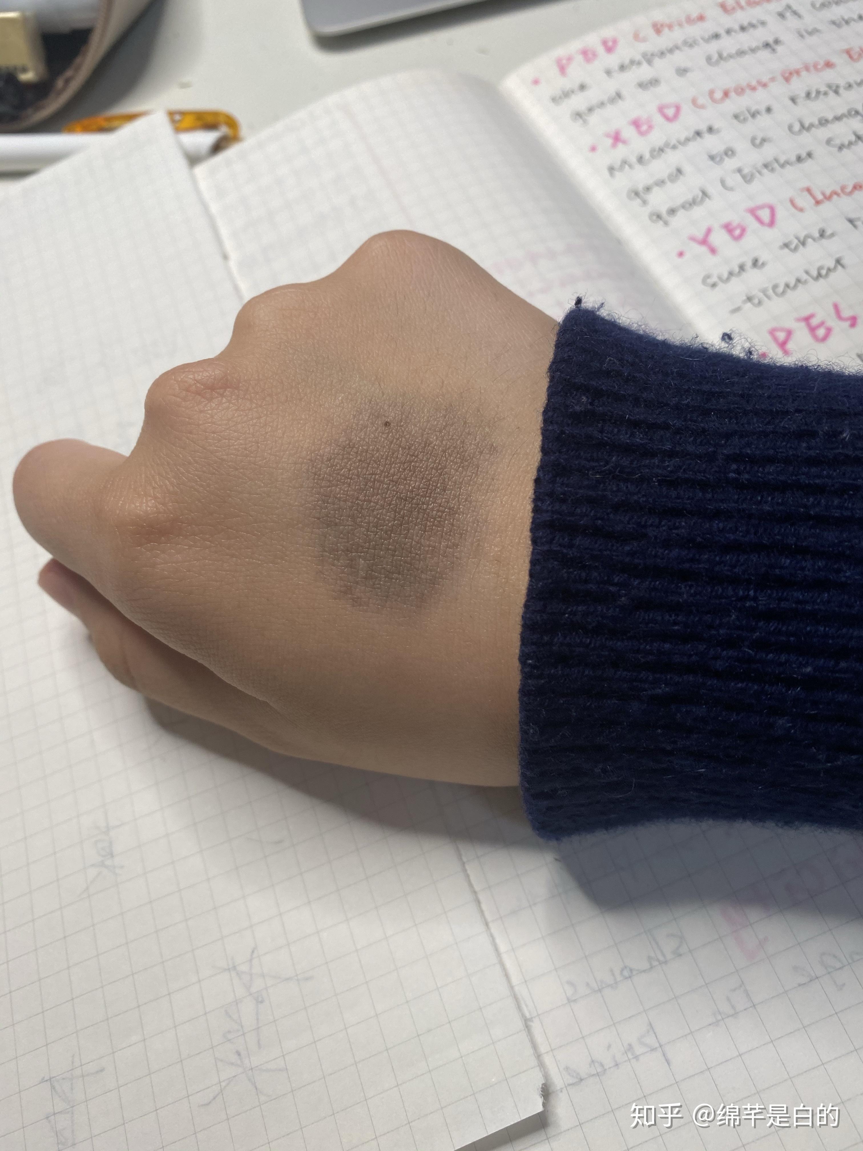 请问你们认识的人中有人的手背正中有一块这样的胎记吗