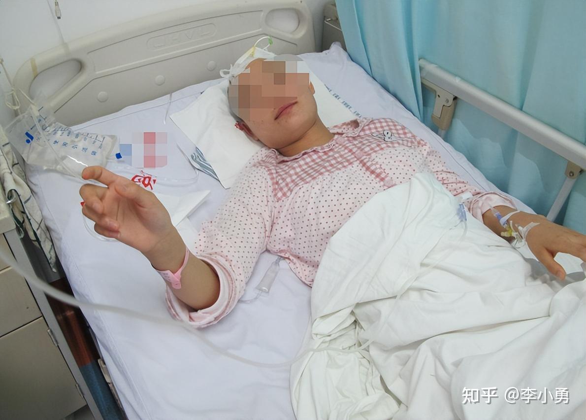 脑积水分流术后现分流感染,病情渐进性加重致昏睡,肢体震颤,芭蕾舞脚