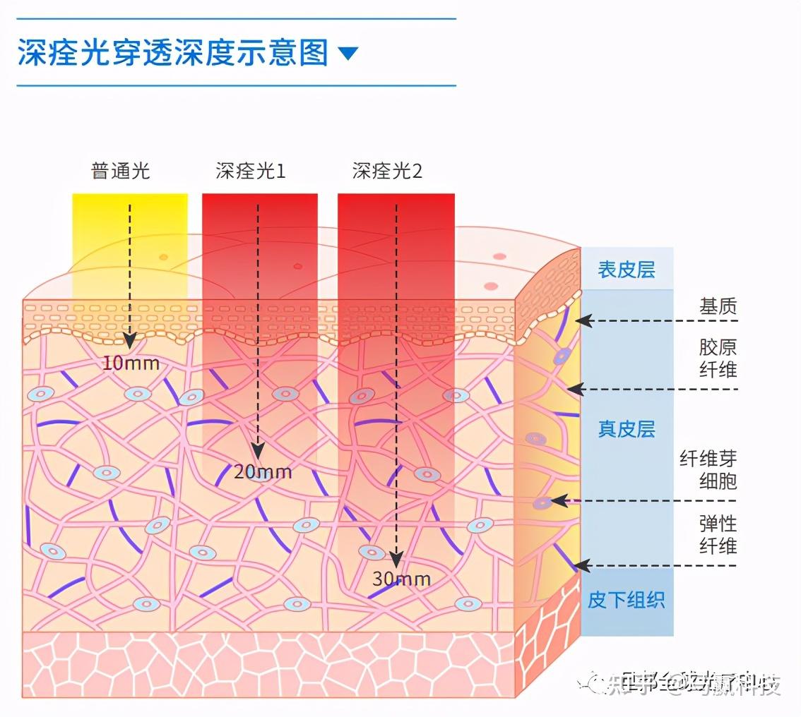 震惊中外的深痊光百元拥有黑科技光疗仪