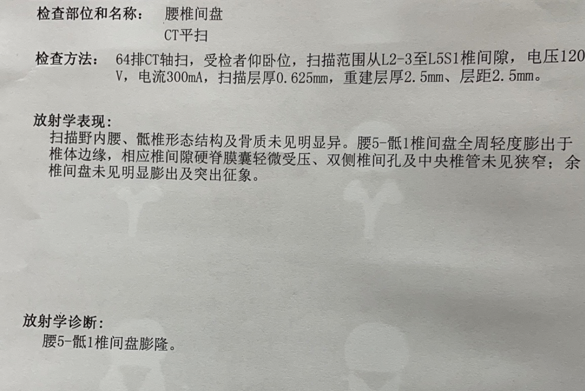 腰5骶1椎间盘全周轻度膨出与椎体边缘