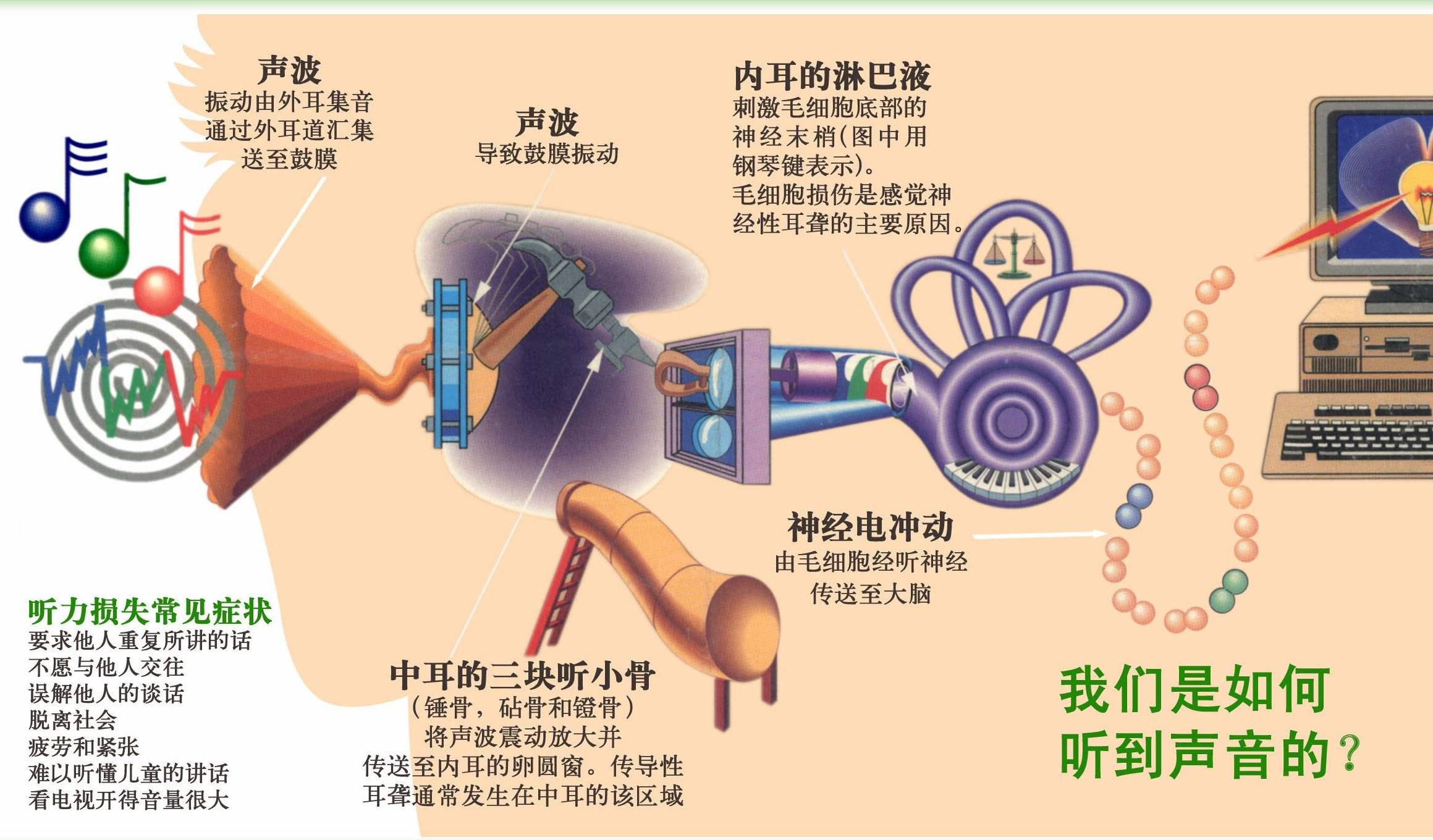 典型小耳畸形病人的残耳表现为花生样赘生物,随年龄不会长大,因此只能