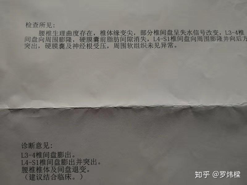 v2-05f0894a8b0639c28e72b0c90147bf86_r.jpg