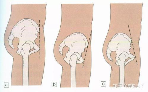 腰边上多了一块 骨头 是因为骨骼精奇么 知乎