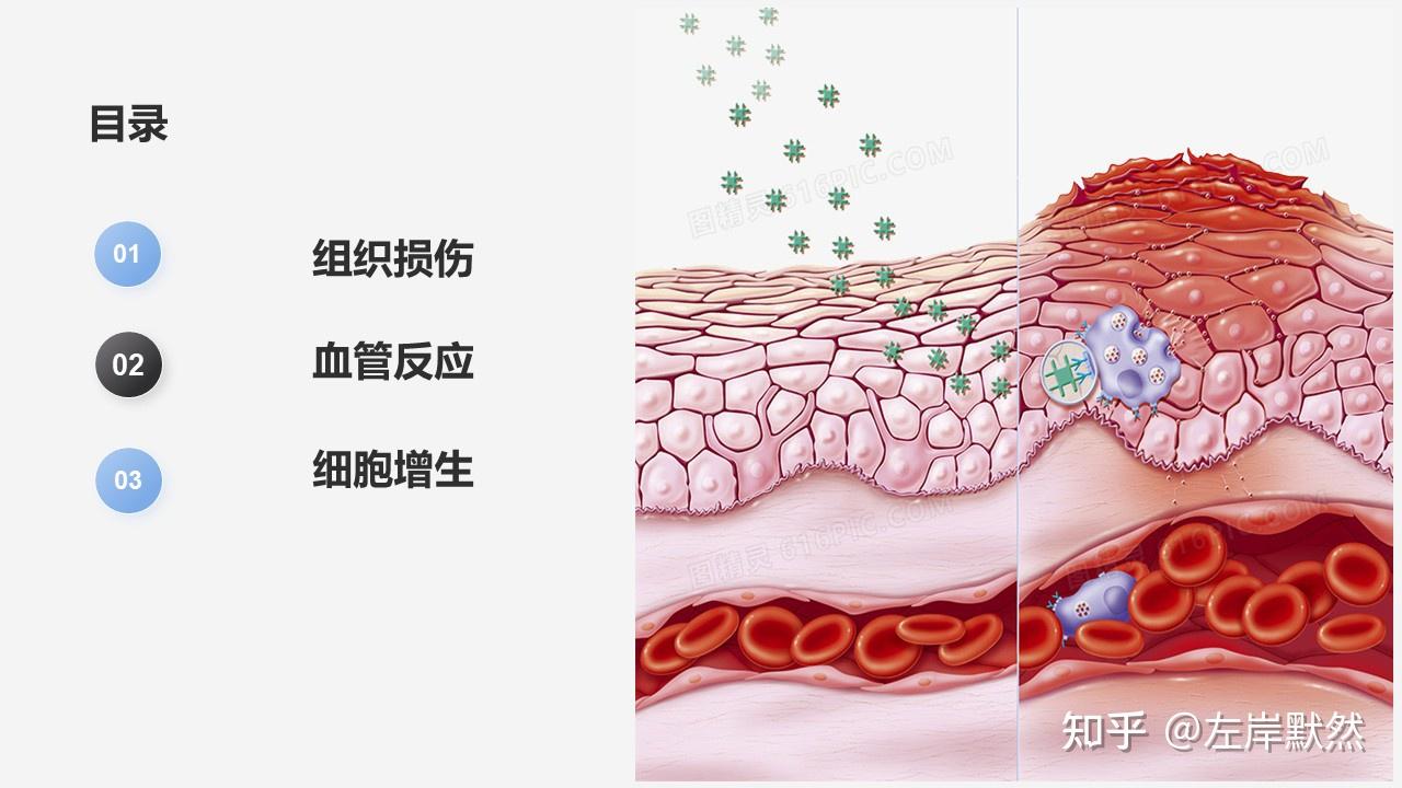 炎症的基本病理变化 - 知乎