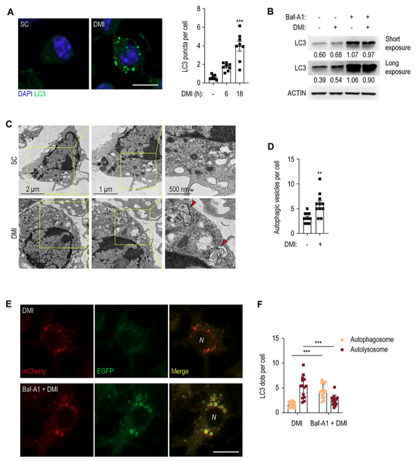 Cell & Bioscience丨IF：9.597丨衣康酸对结核分支杆菌的抵抗作用 - 知乎