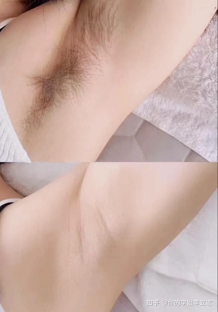 脱毛仪是不是一定要买贵的百元脱毛仪和千元的有什么区别在校大学生更