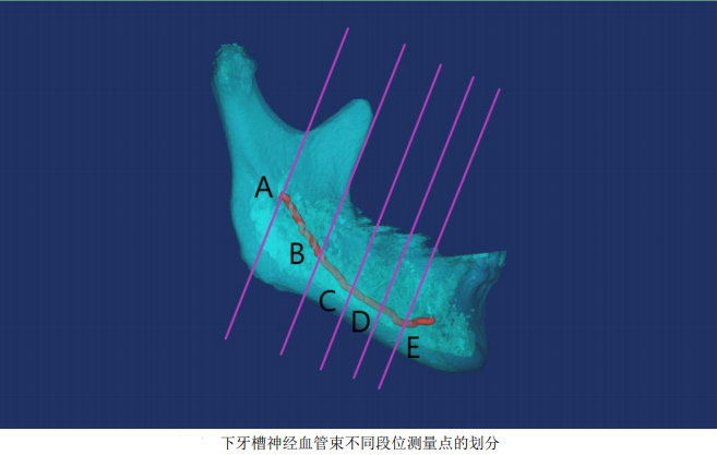 下颌角神经线图片
