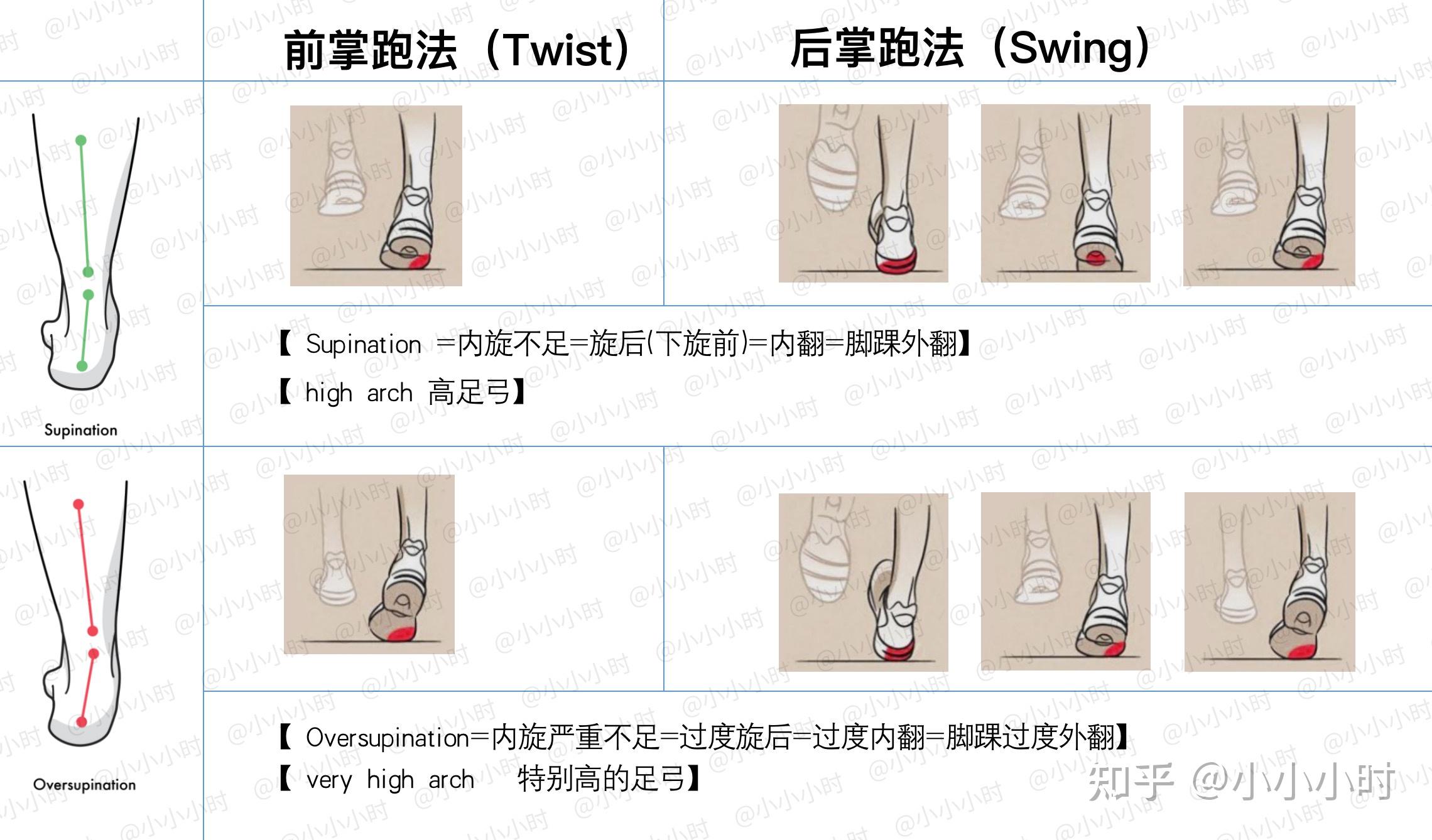 内翻外翻?别再吵了,这个就够了