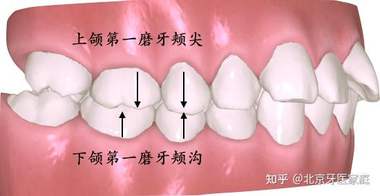 磨牙后三角区域图片