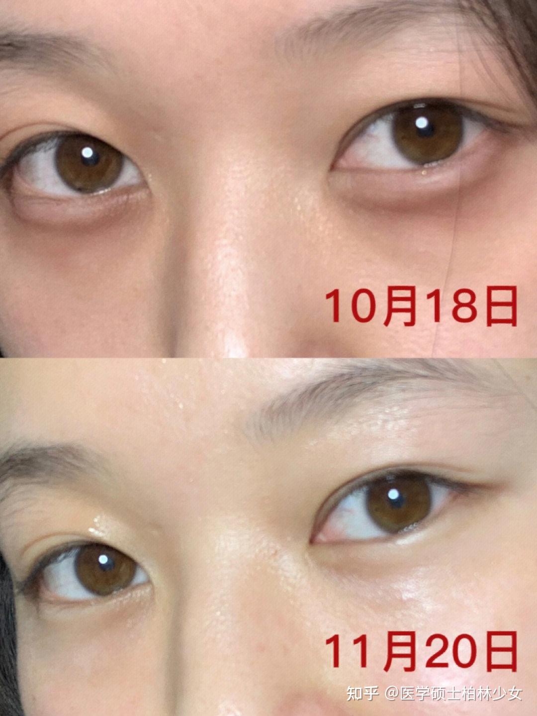 87保湿提亮,修护淡纹——遇见香芬肌肽早晚眼霜