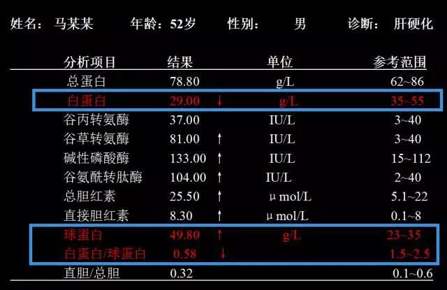 蛋白是人体免疫蛋白,当人体内有病毒时会大量产生,继而导致白球比偏低