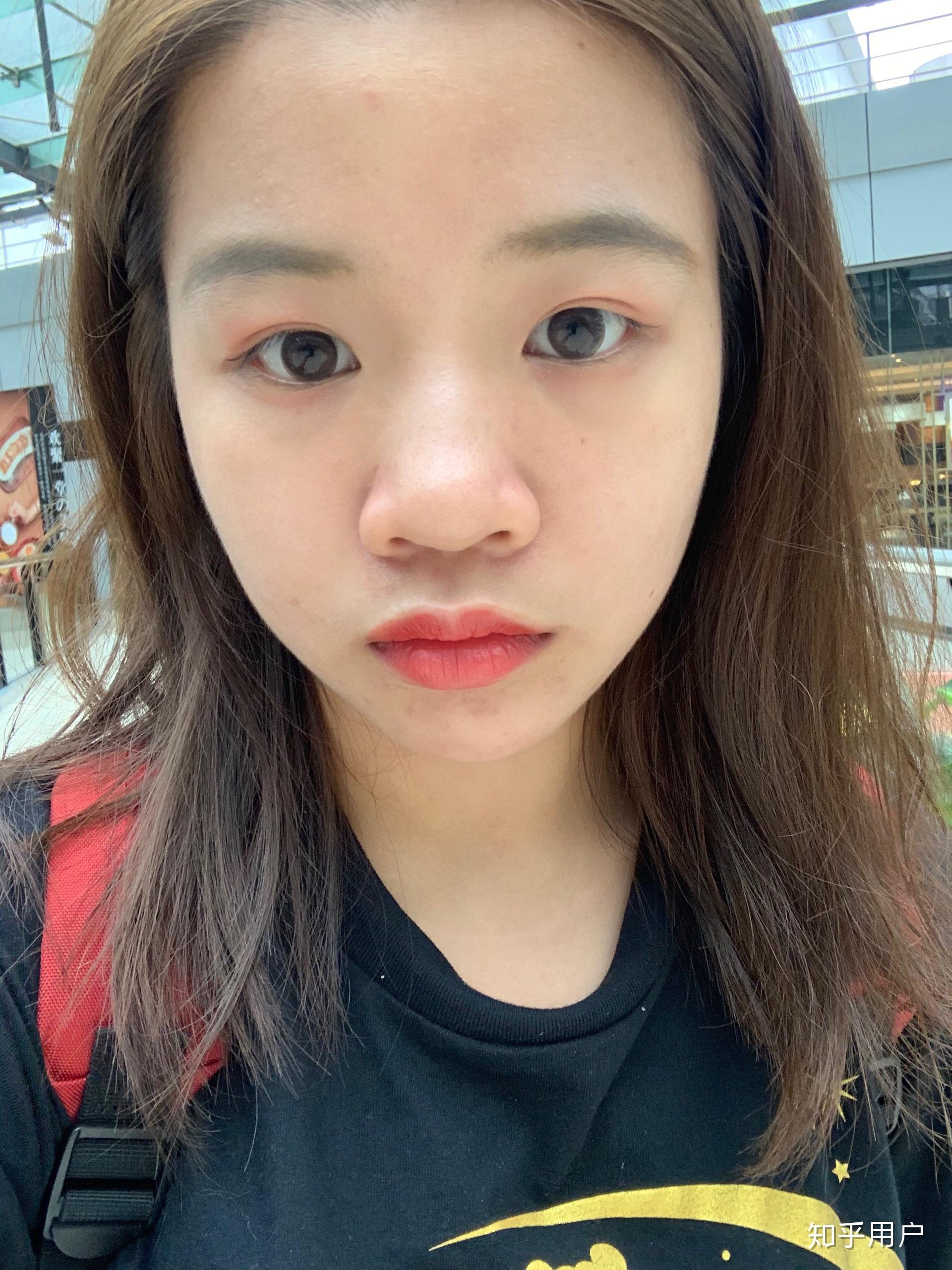 鼻子不好看真的没办法提升颜值了吗